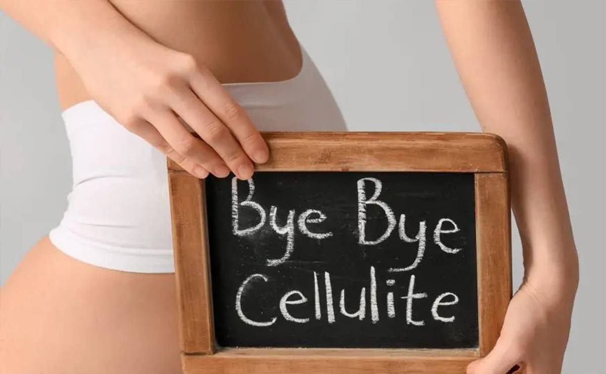 come eliminare la cellulite sulle gambe